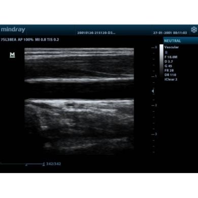 УЗД апарат портативний Mindray DP-30 (MINDRAY) в УЗД апарати.