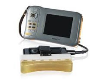Ультразвуковий сканер УЗД FARMSCAN L70 (BMV TECHNOLOGY) в УЗД апарати.